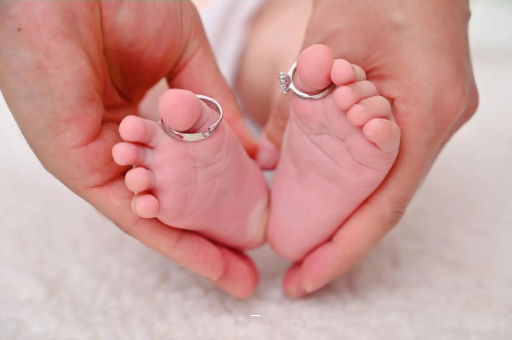 日照孕妇怎样预防妊娠纹